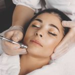 MicrodermPhoto_111424